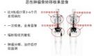 999全讯白菜网核医学科骨检查与治疗